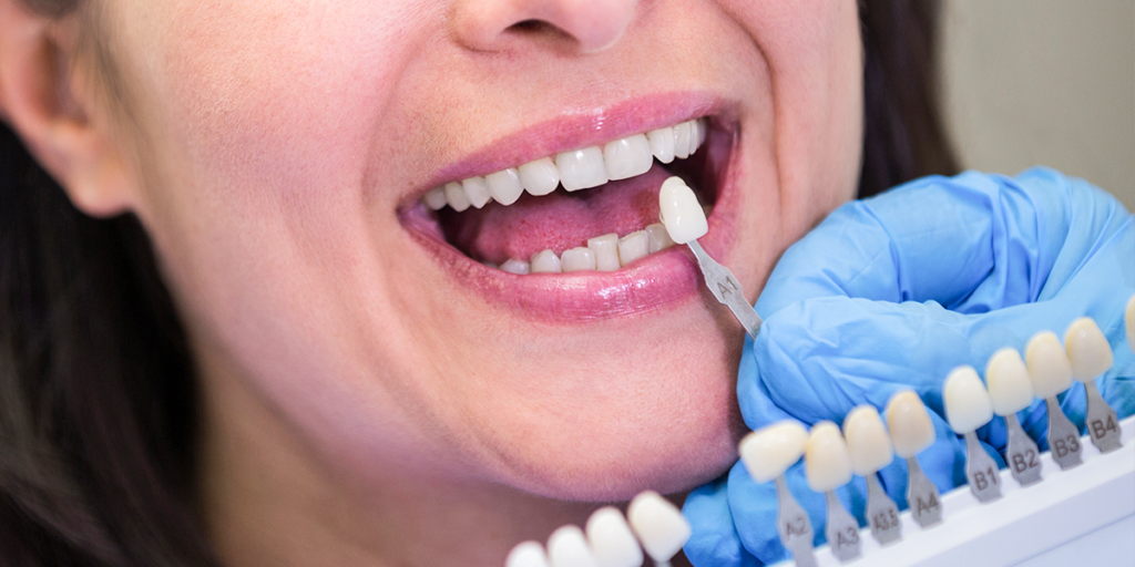 Odontoiatria estetica